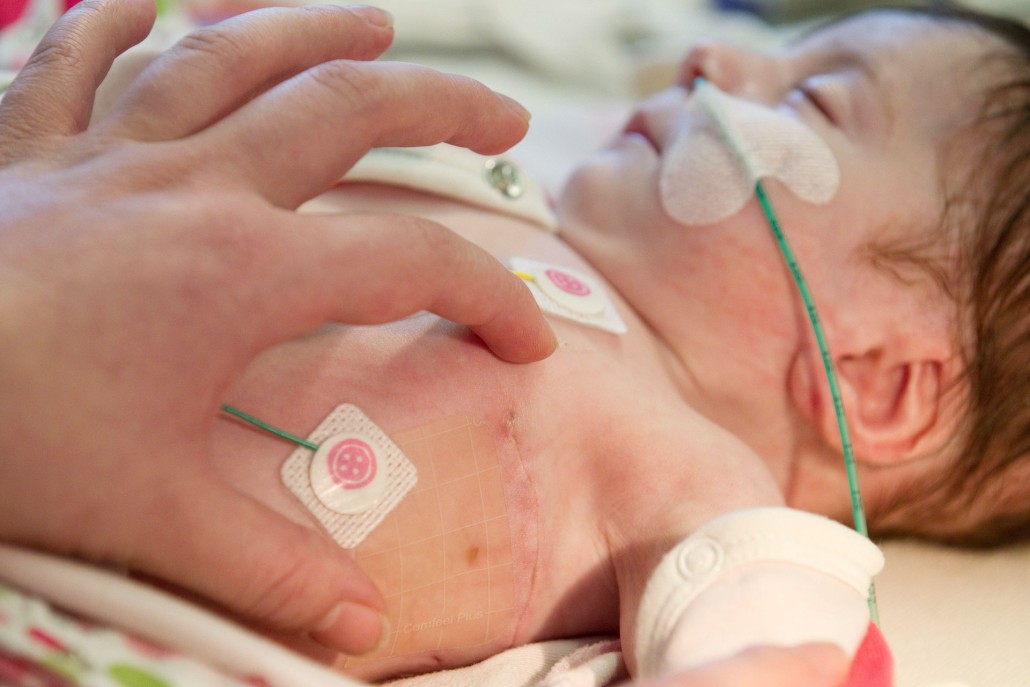 An image of a baby in hospital following open heart surgery.